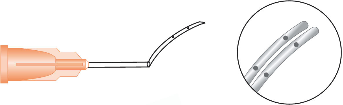 Lasik Irrigating Cannula